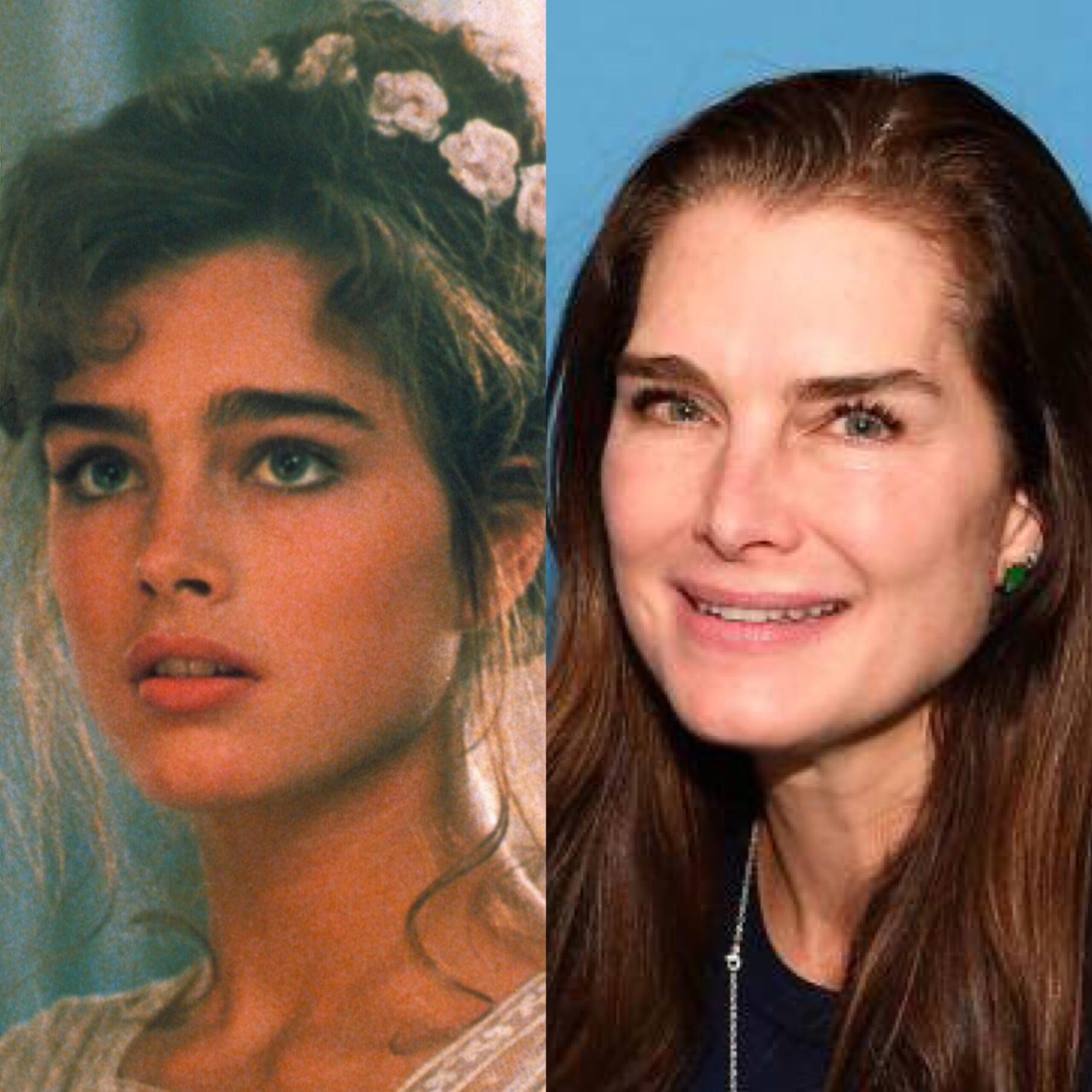 Brooke Shields career evolution from young actress to present day