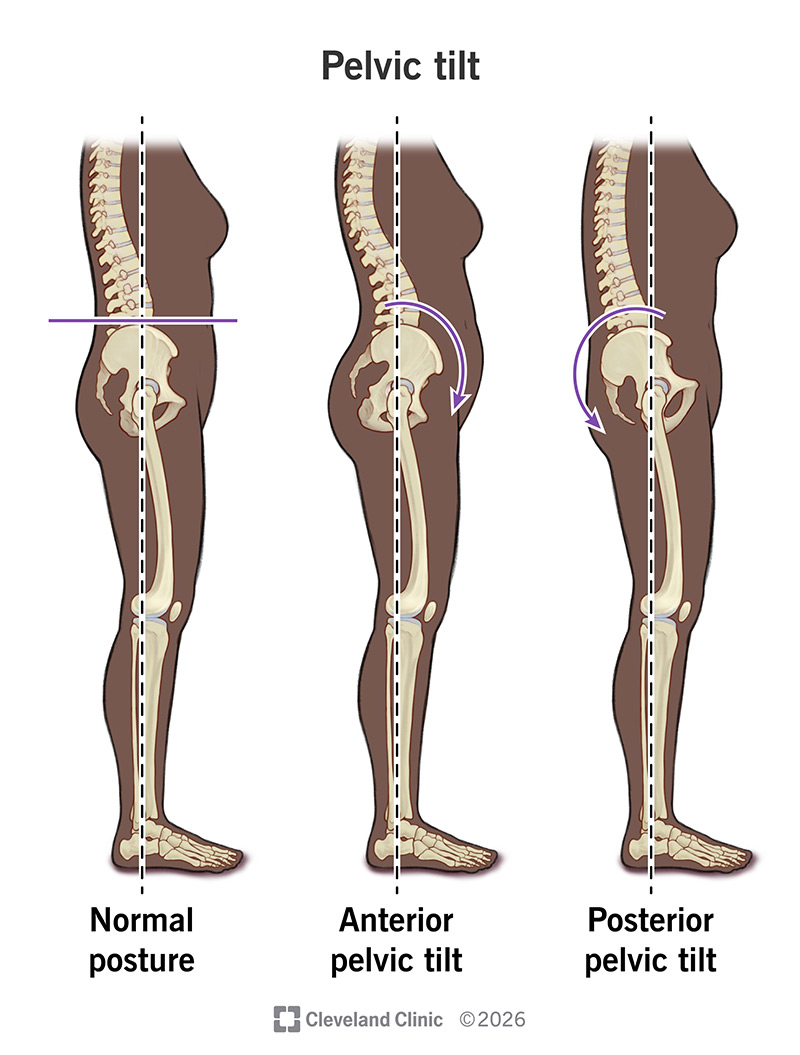 Tems Then vs - The Posture Shift